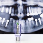 Dental Implant and x-ray picture as background